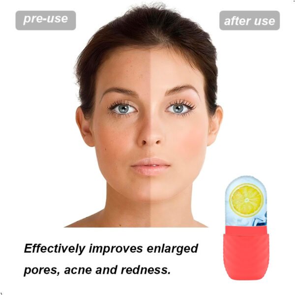 Rodillo Facial Masaje De Hielo Silicona X 2 Unidades