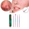 Kit Extractor De Espinillas Y Puntos Negros 4 Unidades Acero