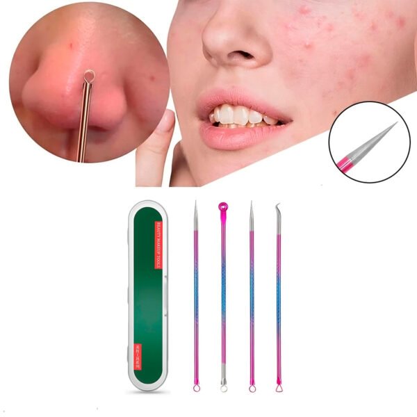Kit Extractor De Espinillas Y Puntos Negros 4 Unidades Acero
