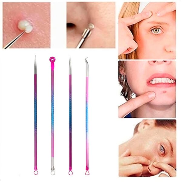 Kit Extractor De Espinillas Y Puntos Negros 4 Unidades Acero