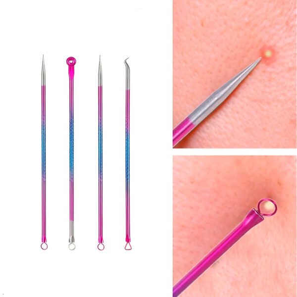 Kit Extractor De Espinillas Y Puntos Negros 4 Unidades Acero