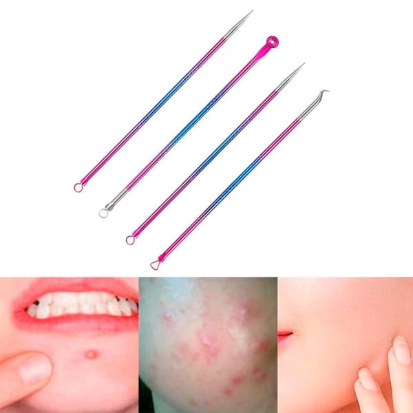Kit Extractor De Espinillas Y Puntos Negros 4 Unidades Acero
