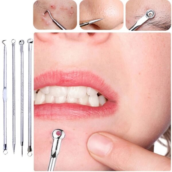 Kit Removedor Extractor Puntos Negros Espinillas 4 Piezas en Acero Inoxidable